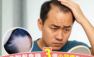 照鏡發現髮線又高咗，有陰都冚唔住？拯救脫髮危機，3個生活小習慣助逆轉；藥劑師推薦食呢樣！
